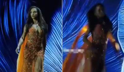  Misica koja je zadobila teške povrede glave objavila slike iz bolnice 