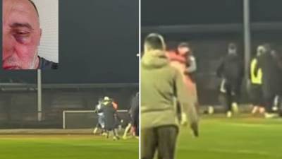  Ne smiruje se haos u BIH: Objavljen snimak tuče u Doboju, fotograf nastradao u žestokoj makljaži 