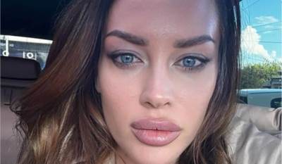  Žena Ognjena Amidžića za 6 dana smršala skoro 4 kg 