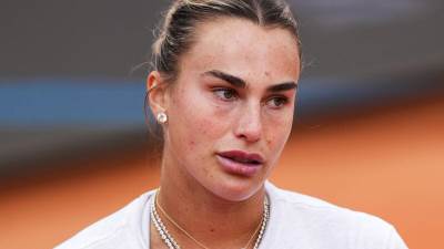  Da li je Arina Sabalenka pretjerala s filerima u usnama? 