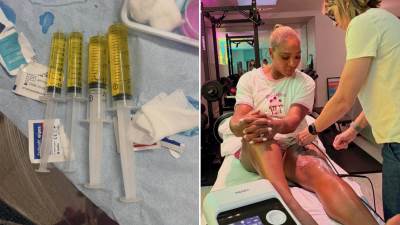  "Ovo su mi ljekari izvukli iz koljena": Serena Vilijams sa Vimbldona objavila uznemirujuće fotografi 