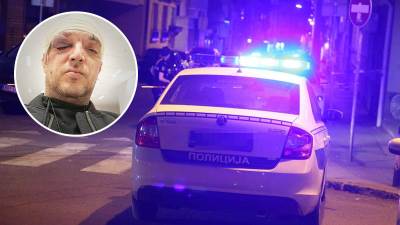  Zoran Marjanović pretučen zbog 20 godina mlađe djevojke? Demantovao da poznaje napadača, isplivali n 