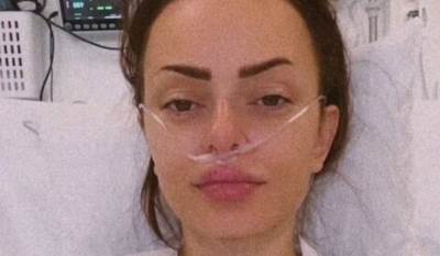  Jeleni Batos izvadili tumor iz glave 